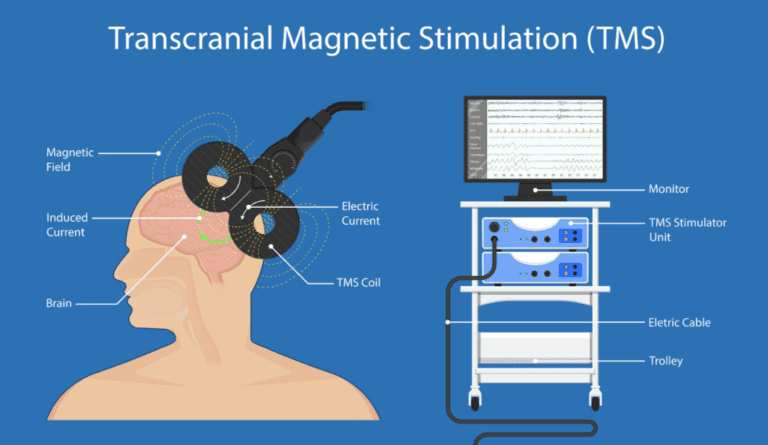 TMS Treatment APN: Non-Invasive Mental Health Treatment Technology